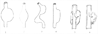 动脉瘤的类型