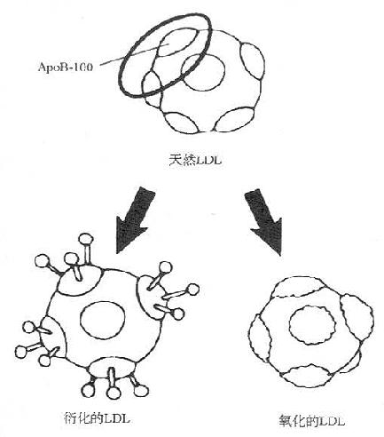 一、修饰的LDL与巨噬细胞泡沫化