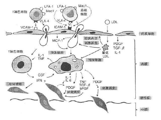 动脉粥样硬化灶内细胞间应答示意图