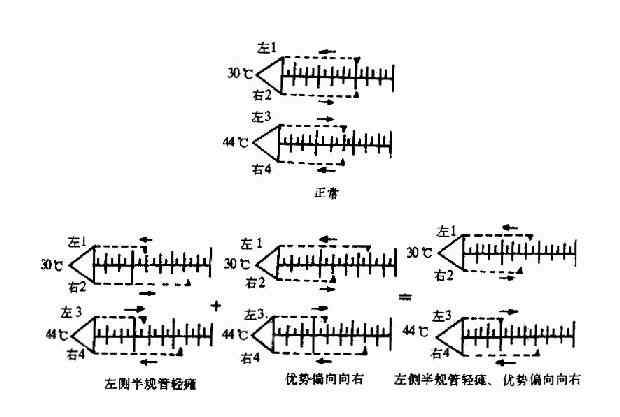 交替冷热试验记录（每小格代表10秒）