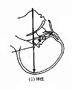 鼻窦置换法