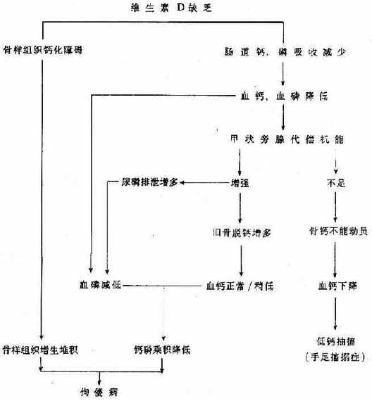 佝偻病及婴儿手足搐搦症发病机理图