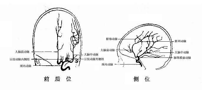 正常颈动脉造影