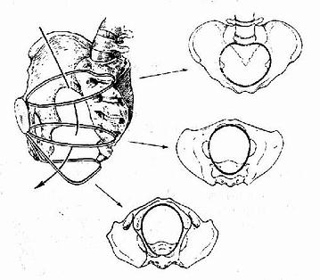 骨盆腔三个平面示意图