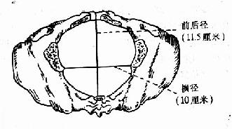 中骨盆平面各径线