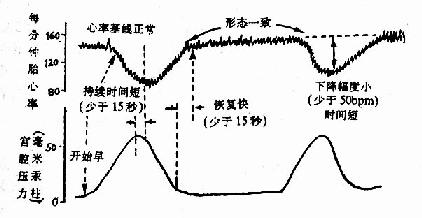 PFHR 早期减速