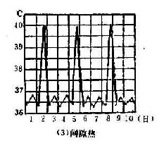 间歇热