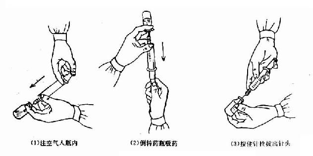 自密封瓶内吸取药液法