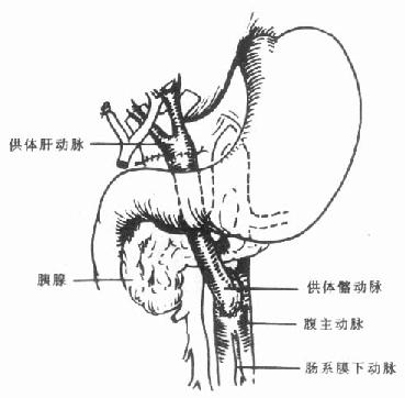 肝动脉吻合