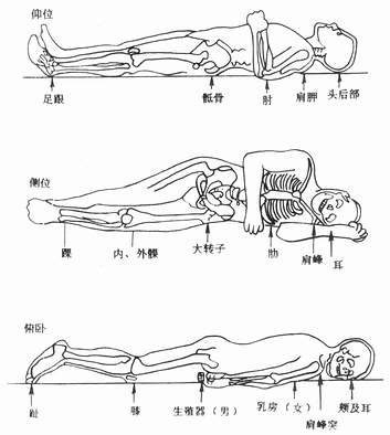 常见受压部位