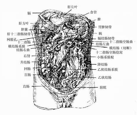 腹膜形成物