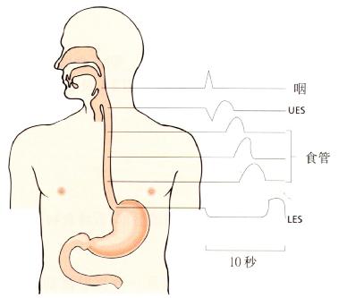 正常吞咽运动时测压结果