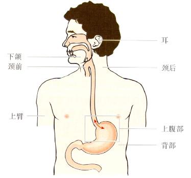 GERD患者疼痛可能分布的部位