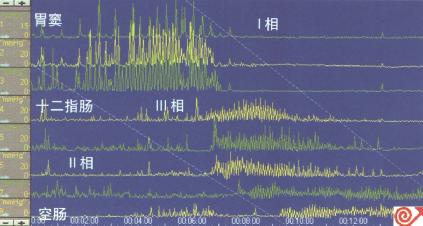 正常人胃窦十二指肠测压