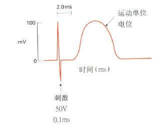 终末运动潜伏期