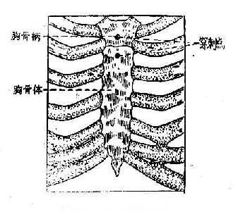 胸骨穿刺点