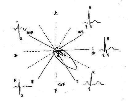 额面心量环与肢体导联心电图的关系