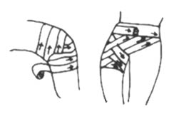 绷带使用法-8字形法