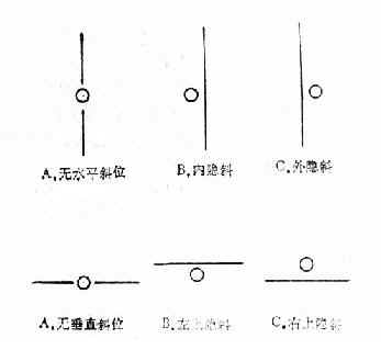 检查结果（马氏杆置右眼前）